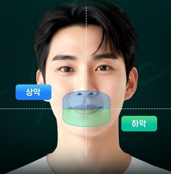 남성 모델 얼굴에 상악(파랑)·하악(초록) 영역과 중심선을 표시한 이미지