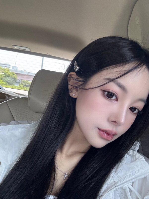 수술 후 1개월 셀피 (2/2)