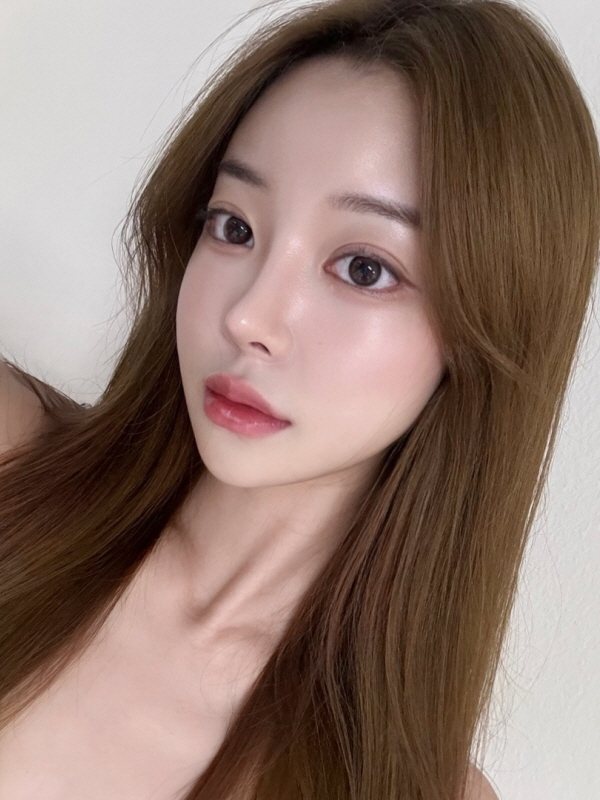 수술 후 5개월 셀피 (1/2)