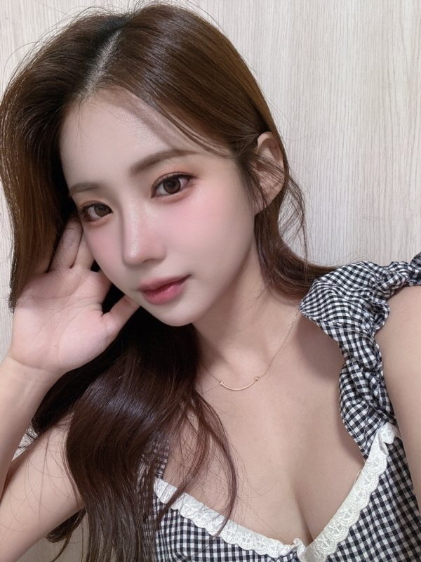 수술 후 3개월 셀피 (1/2)