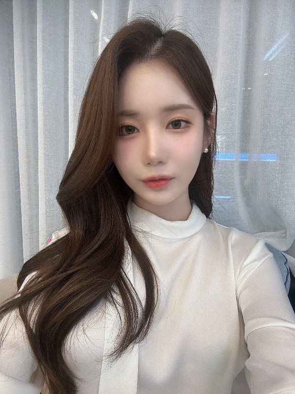 수술 후 5개월 셀피 (1/2)